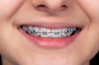 Open Late Dentistry and Orthodontics image 7